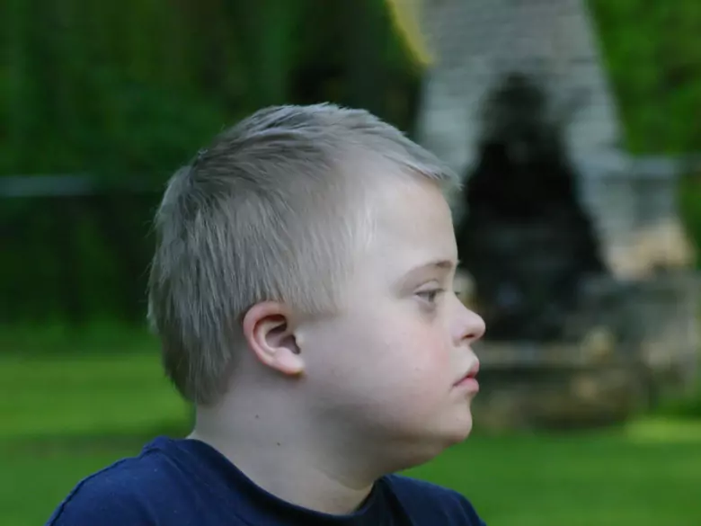 Definicja i rodzaje upośledzenia umysłowego