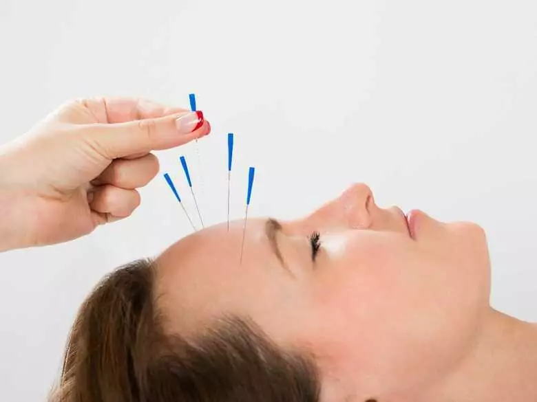 Akupunktura jako metoda walki z problemami emocjonalnymi