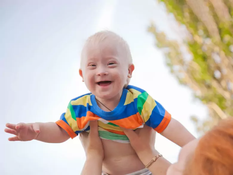 Czy częste prześwietlenia rtg zwiększają ryzyko białaczki u dzieci z zespołem Downa?