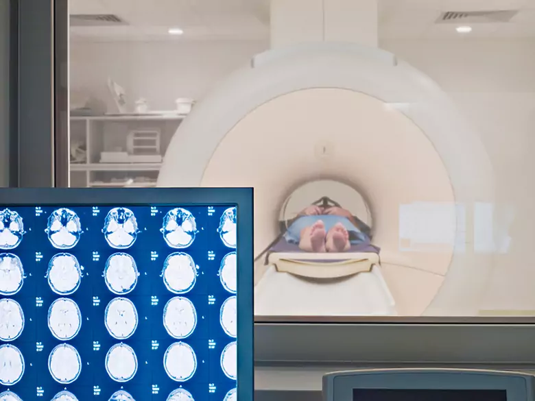 Schizofrenia i zaburzenie dwubiegunowe - jak je odróżnić?