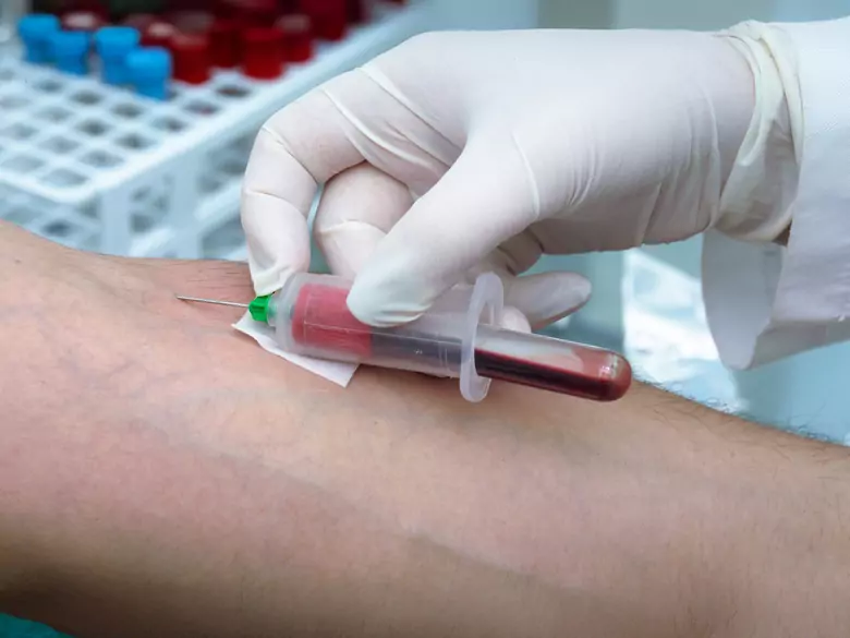 Testy na zawartość narkotyków w organizmie